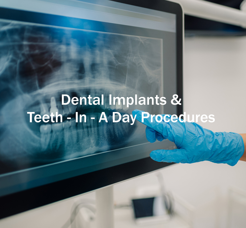 Dental Implants and Teeth In-A-Day Procedure